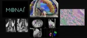 NV_MONAI